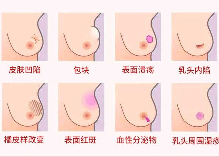 محصولات مراقبت از شخصی ردیاب پستان مادون قرمز برای تشخیص پستان زنان